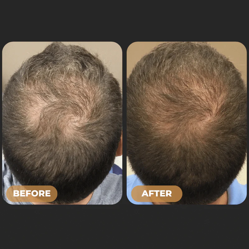 SPARTAN™Root Activator Conditioner